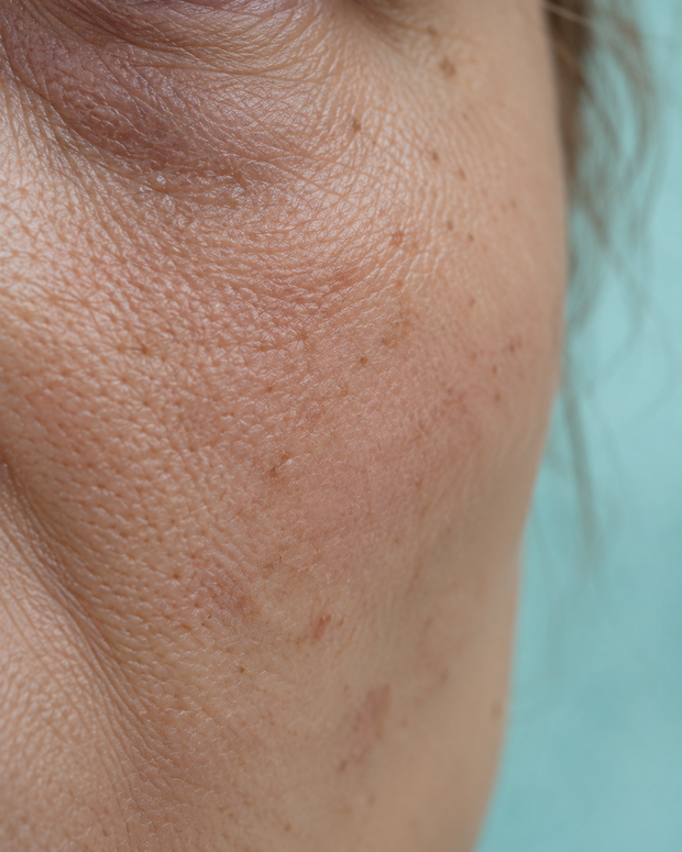 Dull, tired skin