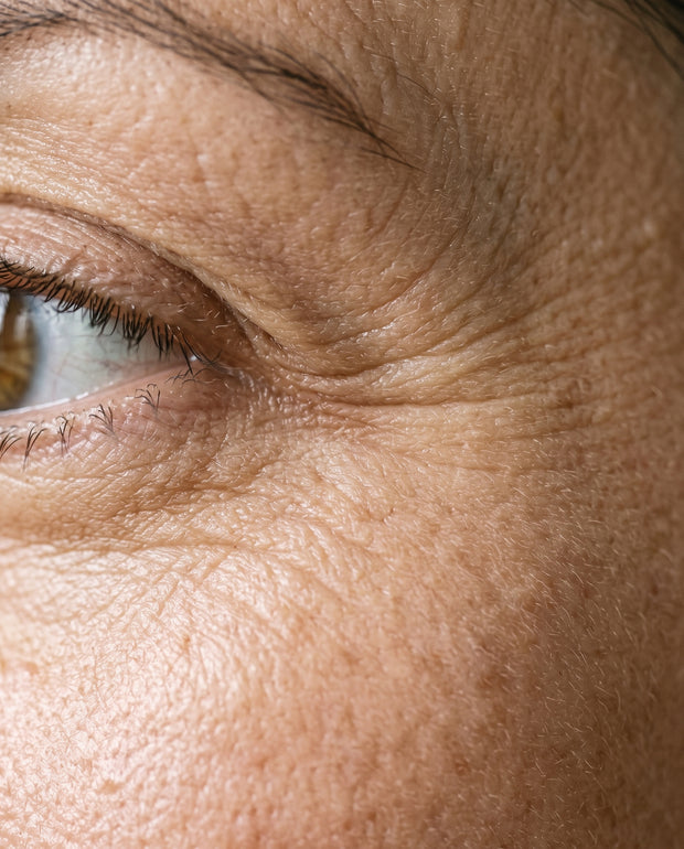 Lines & wrinkles